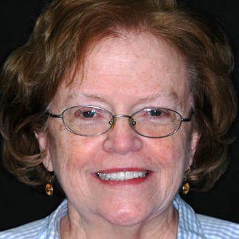 Mary who is an actual cosmetic dentistry patient at Benjamin Turnwald Dentistry