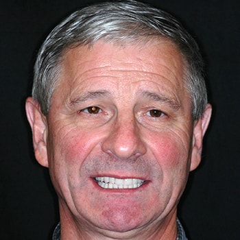 Ihor who is an actual cosmetic dentistry patient at Benjamin Turnwald Dentistry