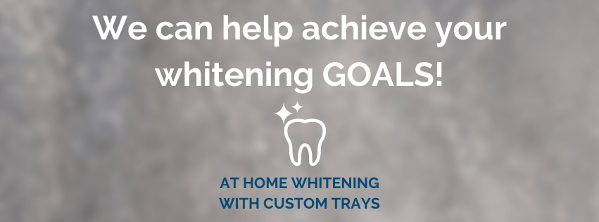 Professional Teeth Whitening at Benjamin Turnwald Dentistry