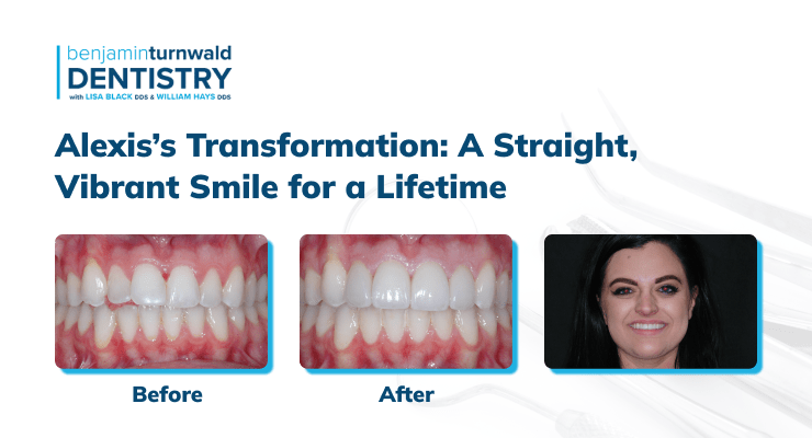 Before, after, and full face image of Alexis’s repaired smile.