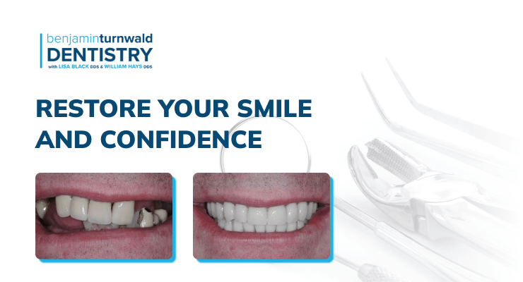 Restore your smile confidence